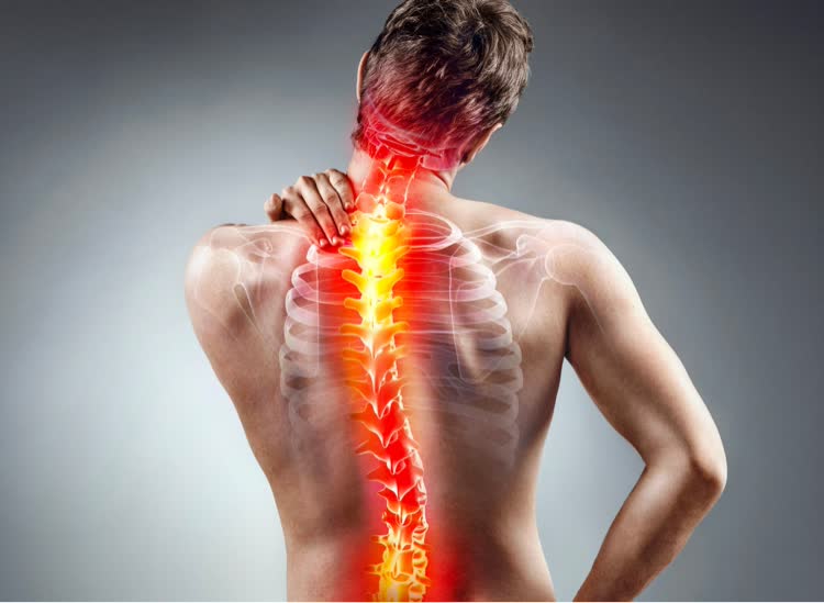 pseudarthrosis-blog-img
