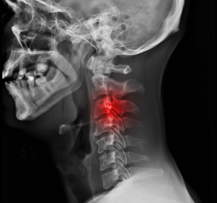 cervical vertebrae anatomy ligaments