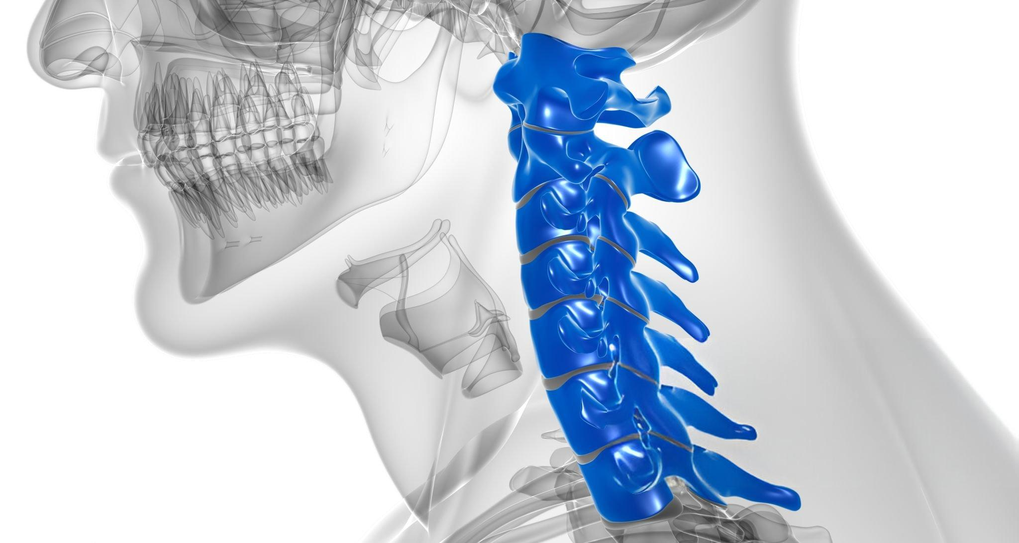 cervical-arthiritis-img